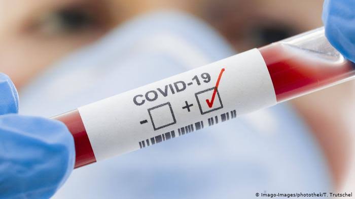 COVID-19 İle Mücadele Kapsamında İlimizde On Farklı Merkezde PCR Testi Yapılmaktadır